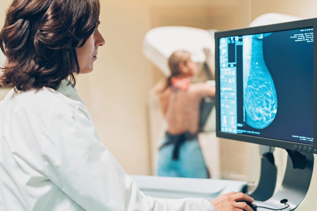 Image showing mammogram for breast cancer detection